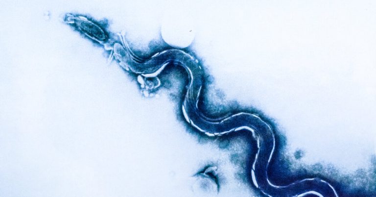 Syphilis Is Hovering within the U.S.