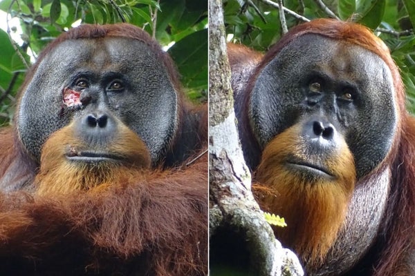Wild Orangutan Makes use of Natural Drugs to Deal with His Wound