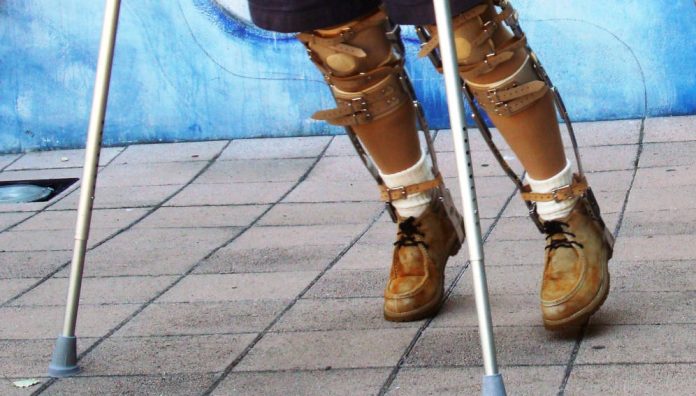 ray3578 Crutches and swinging leg braces